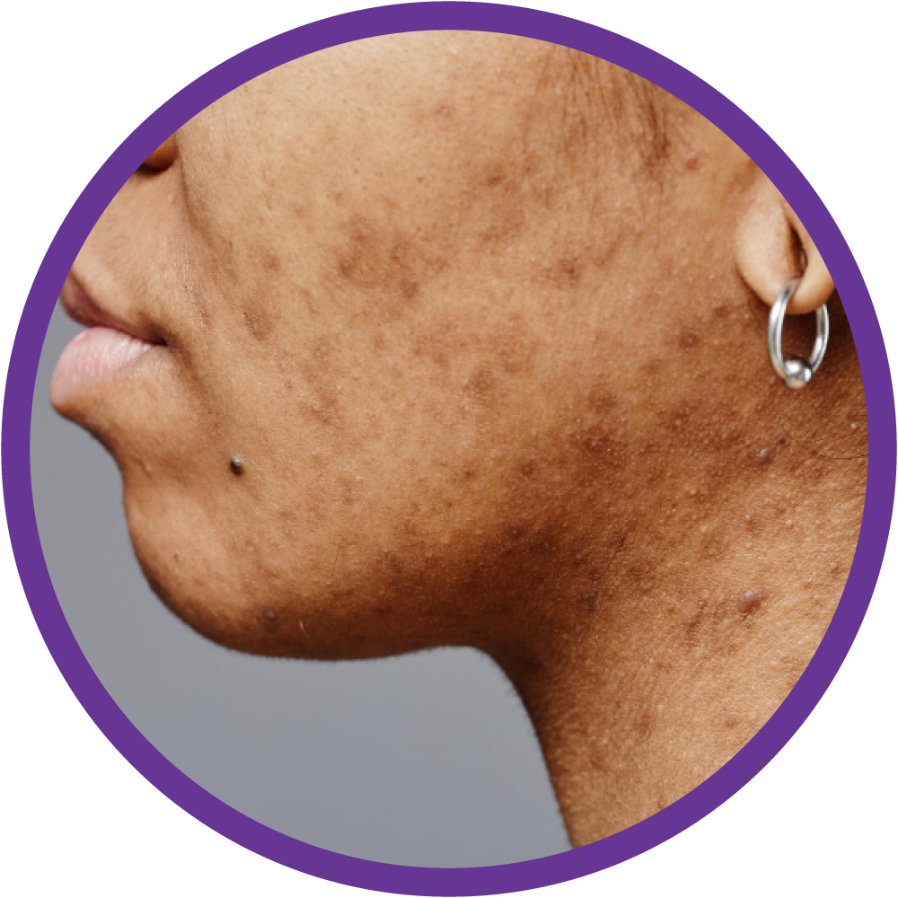 placeholder image-sq