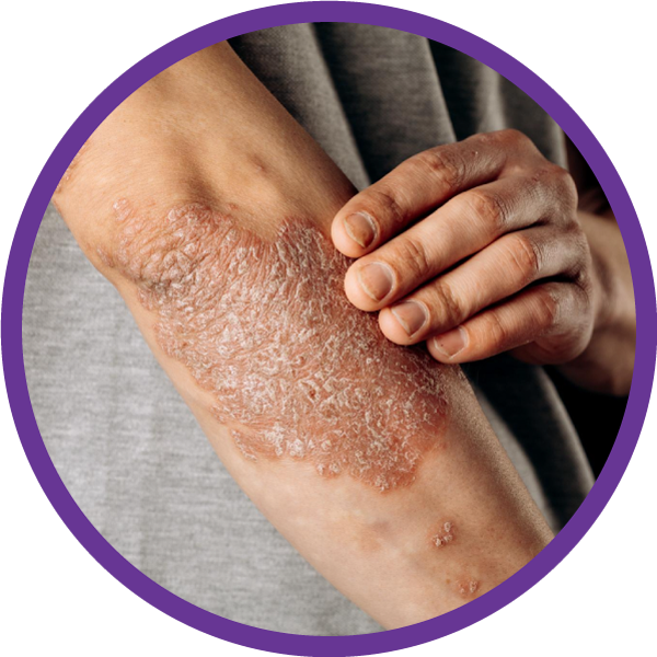 placeholder image-sq