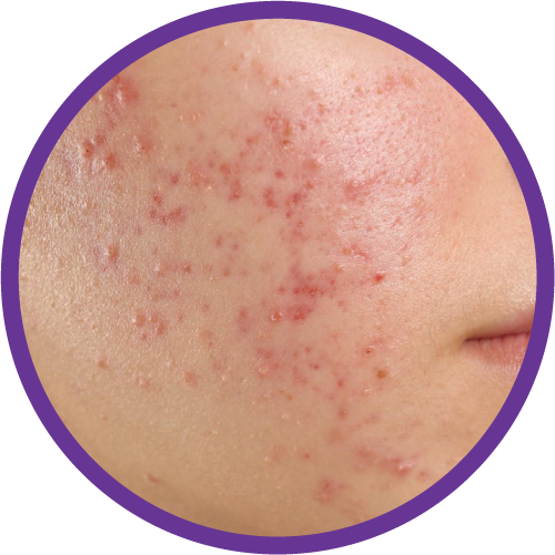 placeholder image-sq